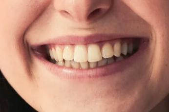 Trust me I’m a dentist” - common dental misconceptions debunked