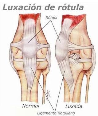 Cover for Luxación patelar en caninos