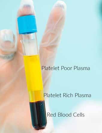 Cover for Platelet Rich Plasma (PRP