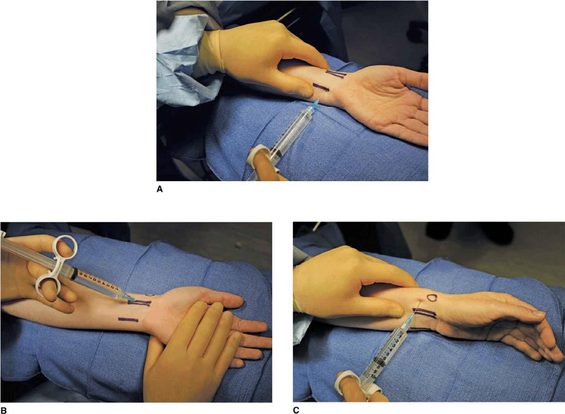 Figura 68 – Bloqueio anestésico de nervos - Issuu