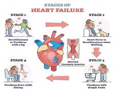 Cover for Insuficiența cardiacă – principala cauză de mortalitate mondială