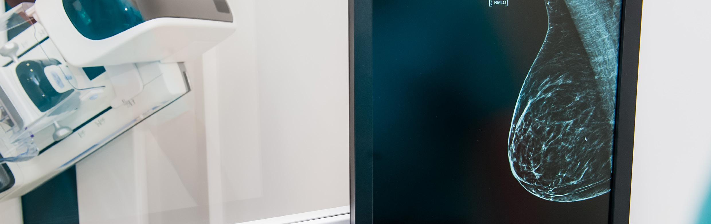 Cover for Market Report