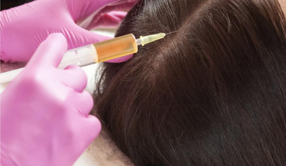 How to Regrow Hair with the Growth Factor Rejuvenation Technique! by