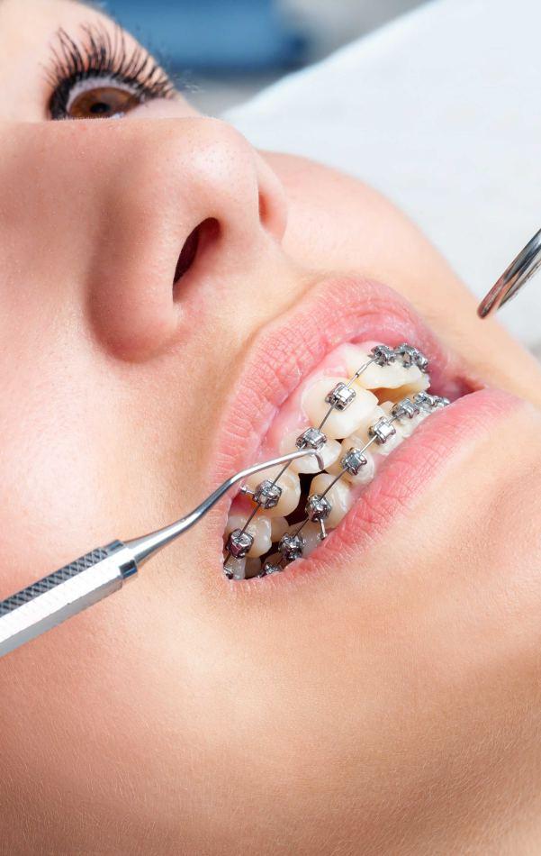 Brilliant Orthodontics Orthodontic Products Catalog by Brilliant