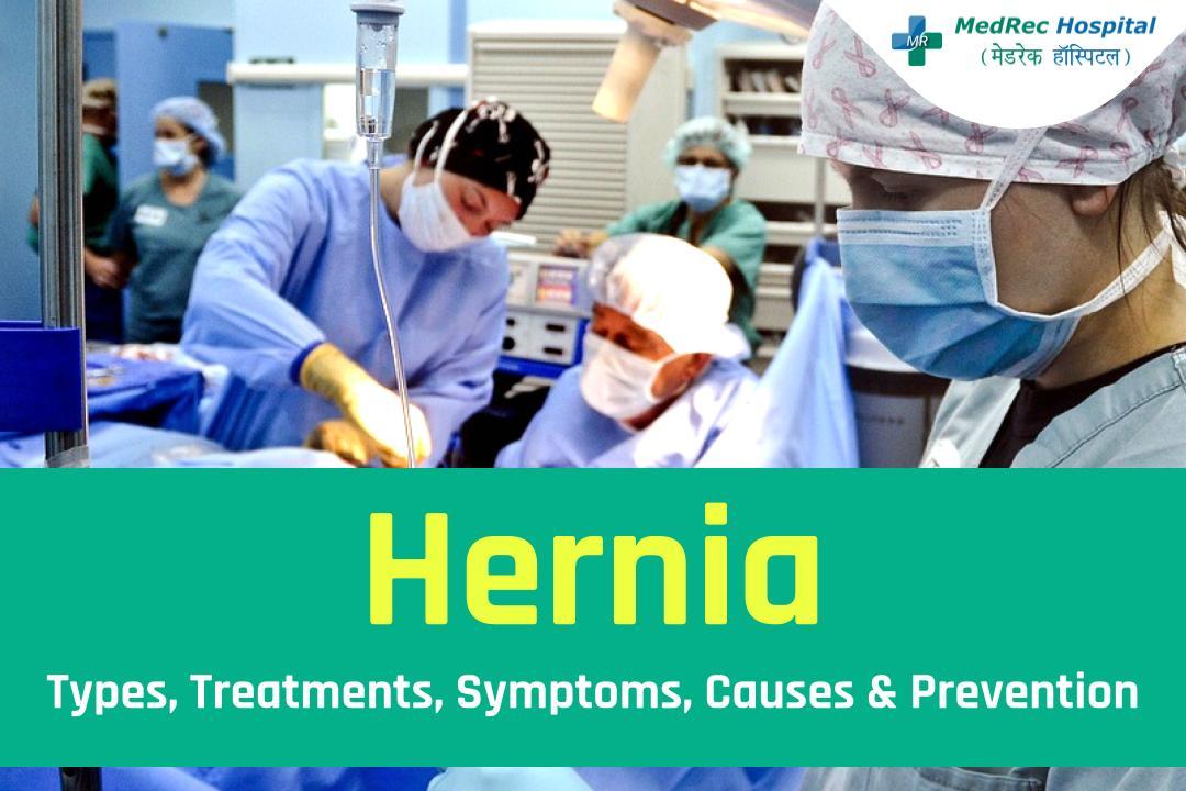 Hernia Types, Treatments, Symptoms, Causes & Prevention by MedRec