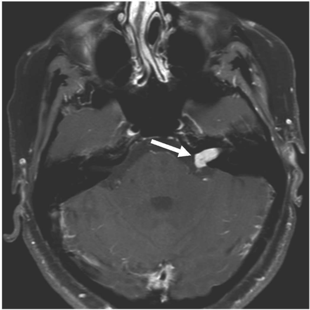 Newly Diagnosed Handbook by Acoustic Neuroma Association Issuu