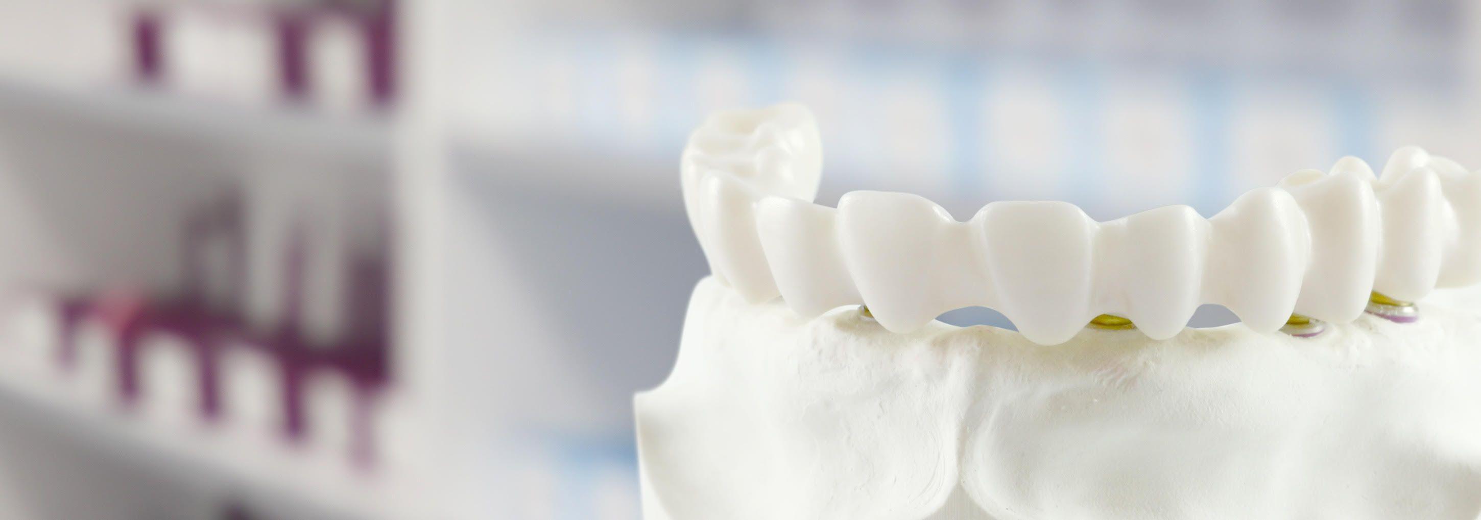 Introducing The Simple Way To Zirconia Crown by dentcare dental Issuu