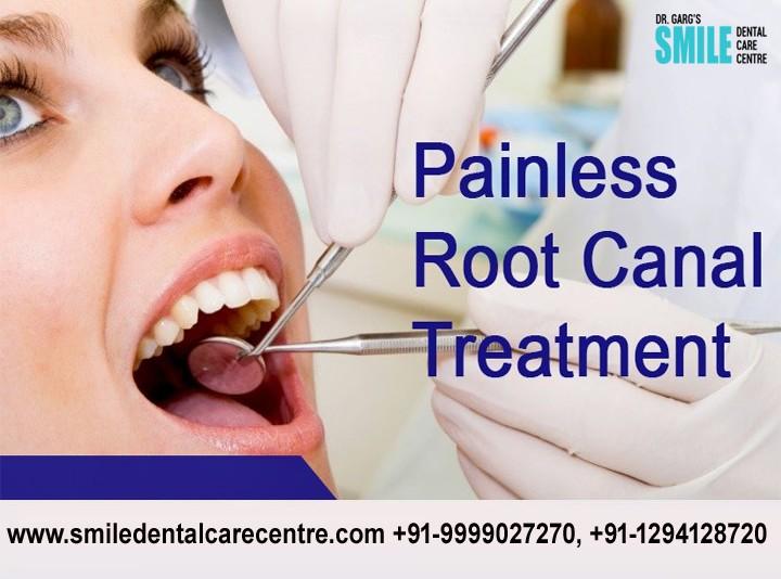 How To Get Discovered With dental laminates