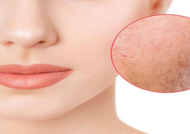 Laser Hair Removal Cary Nc by AJC Medical Issuu