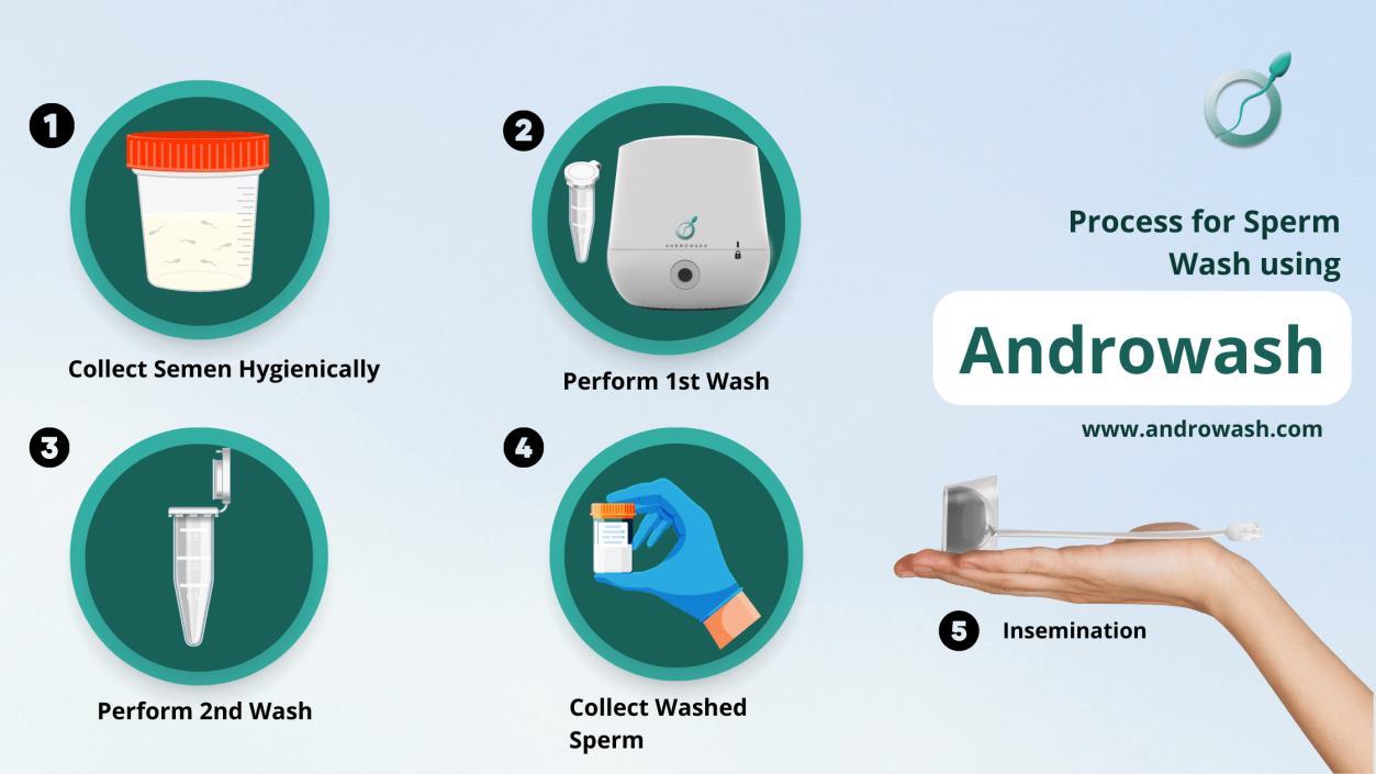 Understanding Sperm Washing for Sperm Selection by Andro Wash Issuu