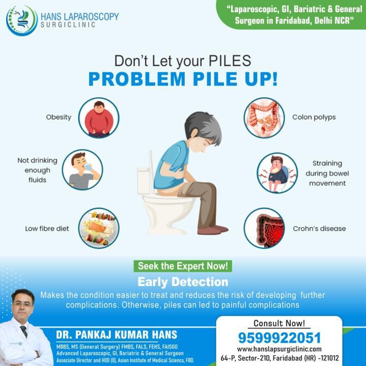 Who Is the Best Piles Specialist Doctor in Faridabad by Story Web