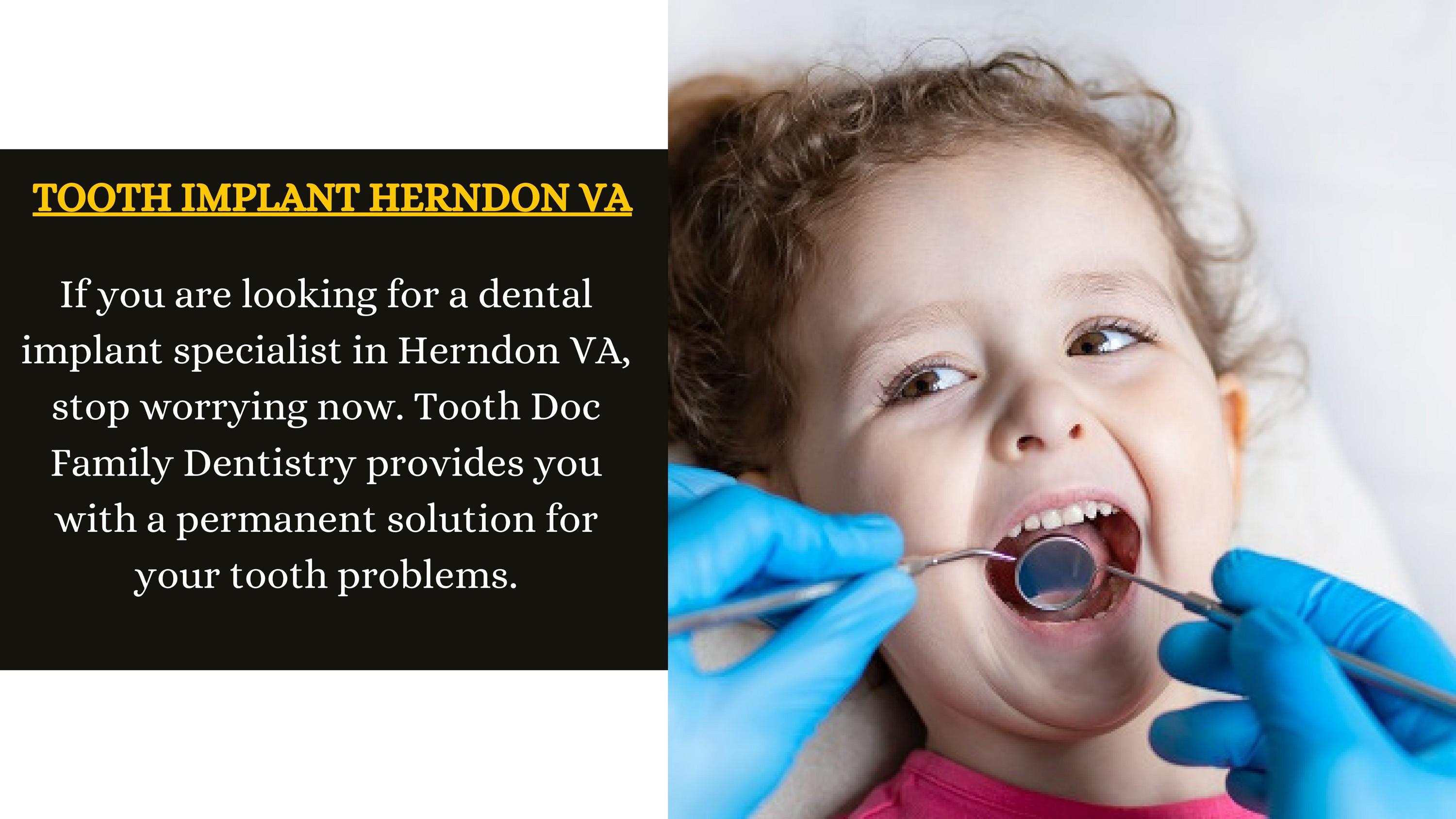 Tooth Implant Herndon VA Tooth Doc Family Dentistry by Tooth Doc