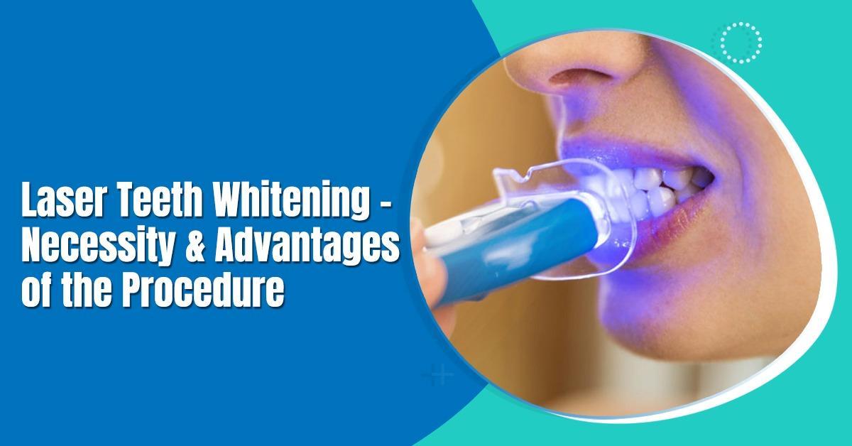 Laser Teeth Whitening Necessity and Advantages of the Procedure by