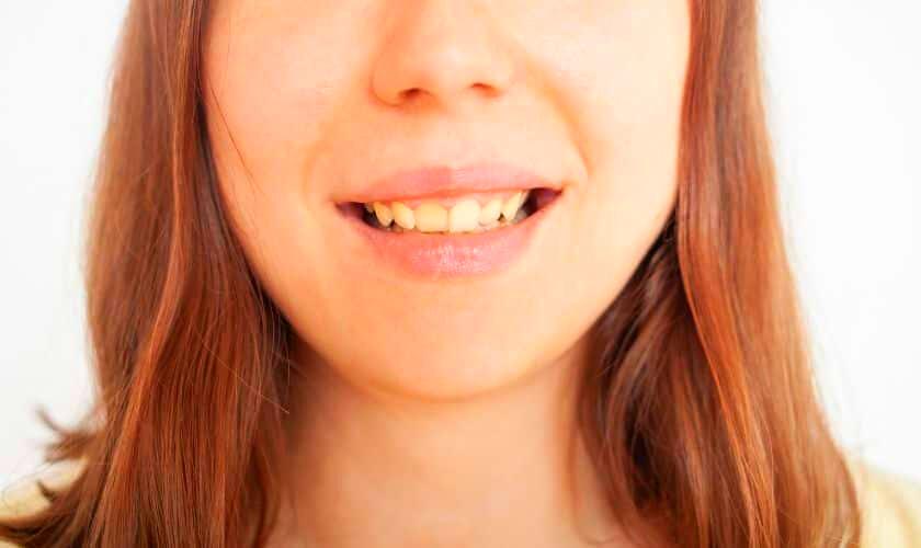 Health Problems That Can Make Your Teeth Yellow And How To Prevent Then