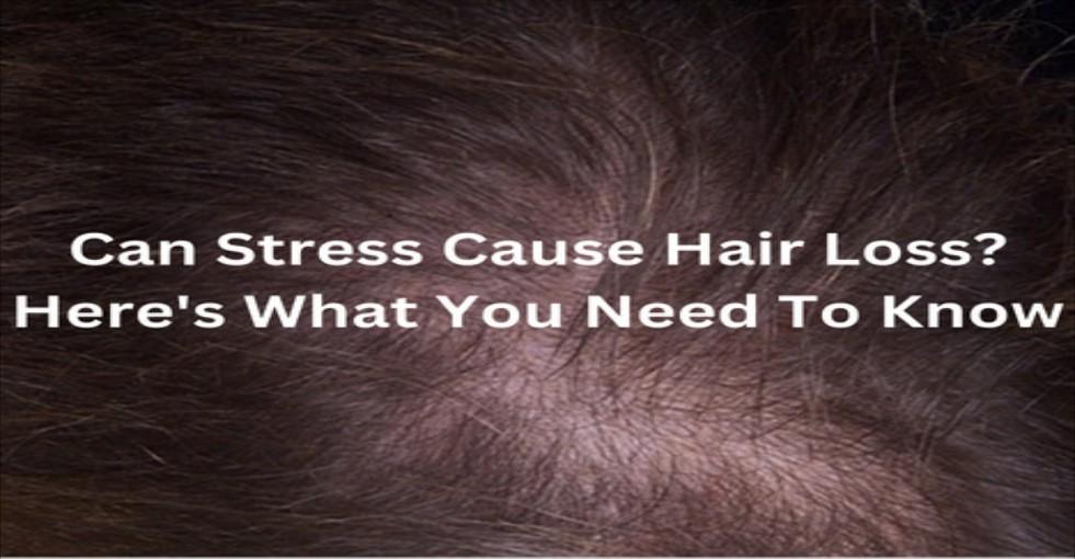 does-stress-contribute-to-hair-loss-what-you-need-to-know-by-b-vertex