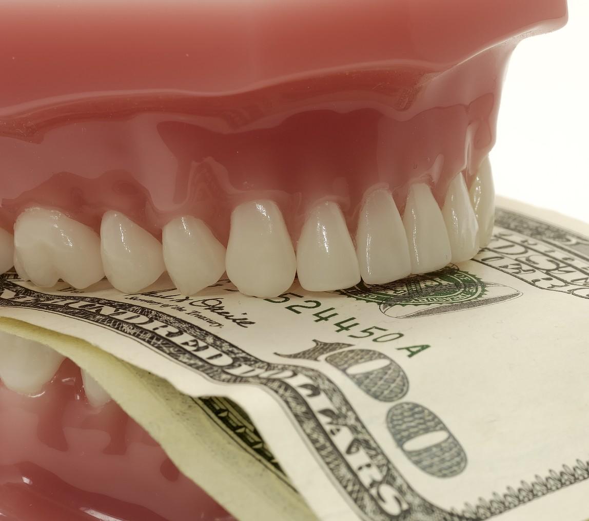 What is the cost of Dental Veneers in Australia? by Dentist wollongong