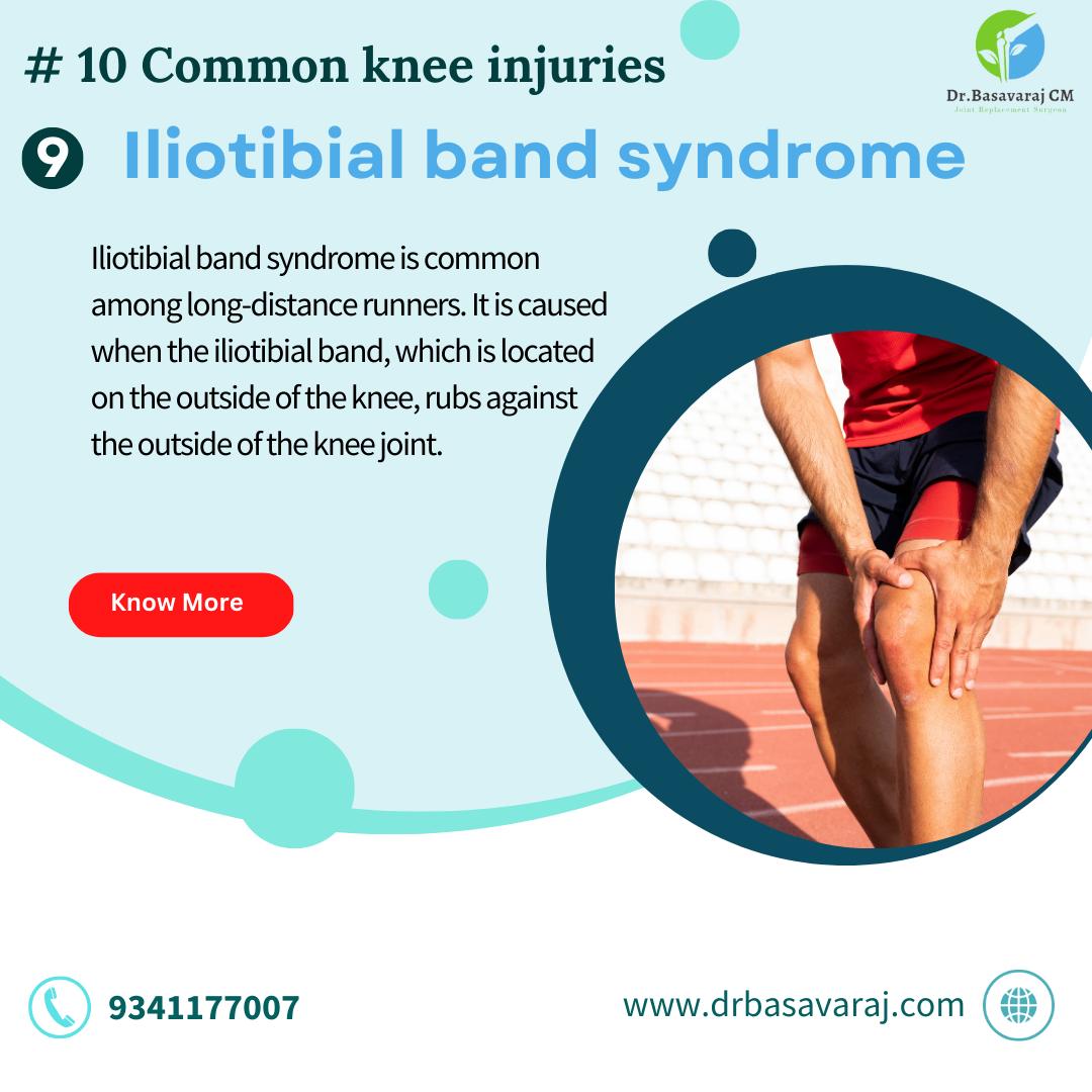 Iliotibial band syndrome Best Orthopedic Surgeon in RR Nagar Dr