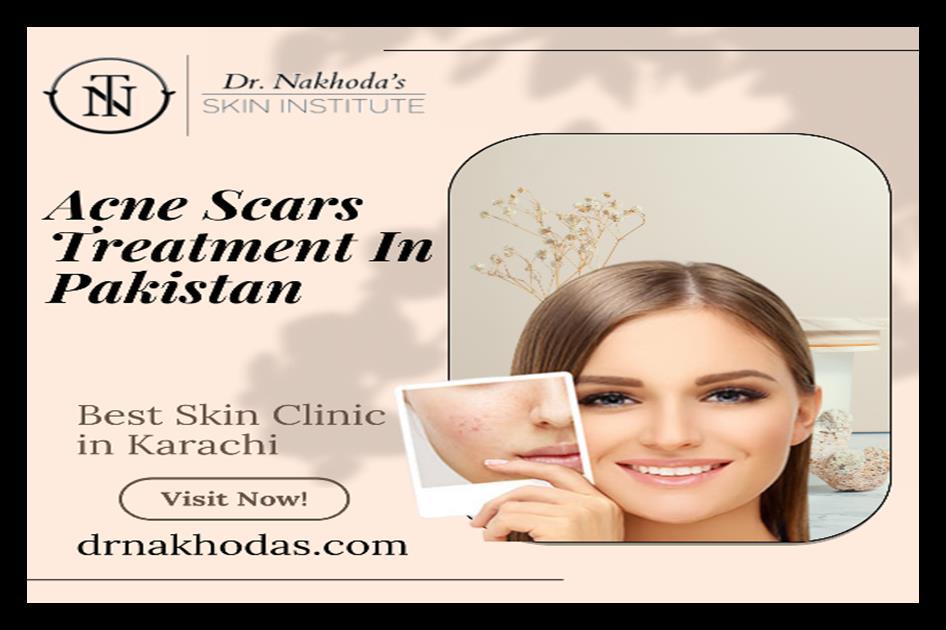acne scars treatment in Pakistan by Dr. Nakhoda Issuu