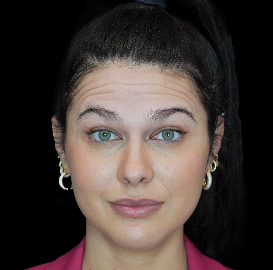 LaserAway Services Lookbook by LaserAway Issuu