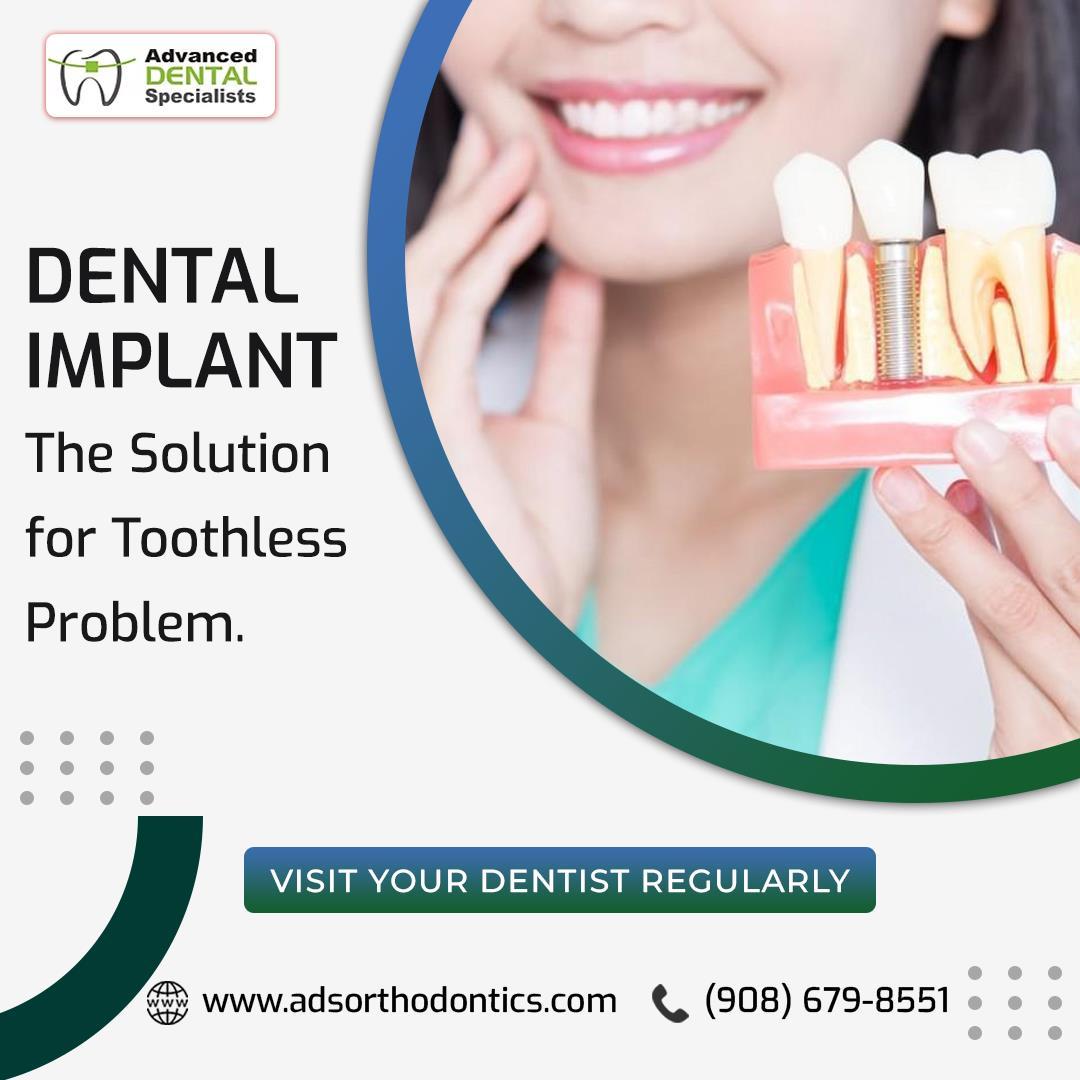 Affordable Dental Implant in Berkeley Heights New Jersey by