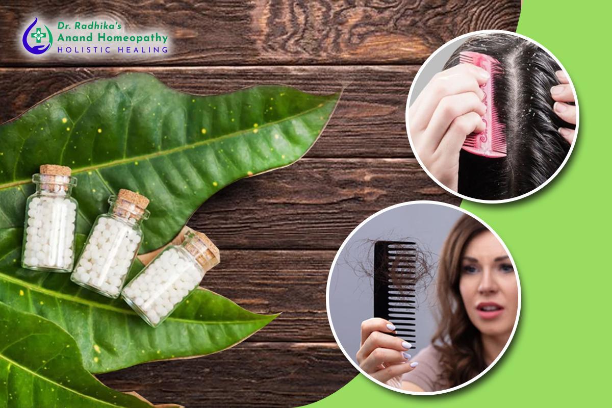 Does homoeopathy actually work for hair loss? Here is your answer by