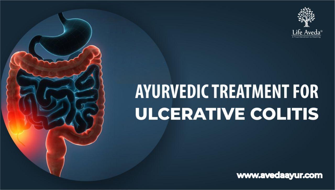 natural medicine for ulcerative colitis by nigam120 Issuu