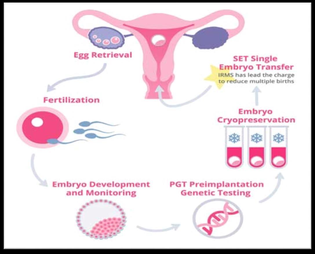 Explaining the Different Stages of the IVF Process by acemedicarein Issuu