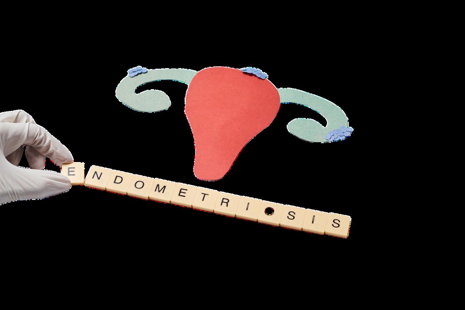 Understanding Endometriosis by Manjiri Nadkarni Issuu