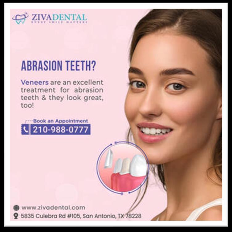 Dental Veneers Meaning And Aftercare Tips by Ziva Dental Issuu