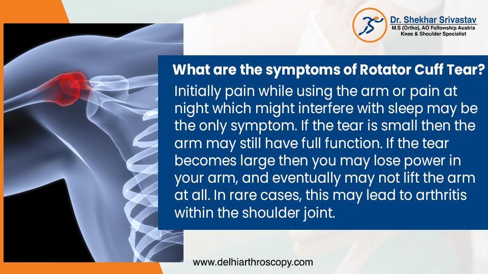 Frozen shoulder vs shoulder Arthroscopy Leading Shoulder Arthroscopy