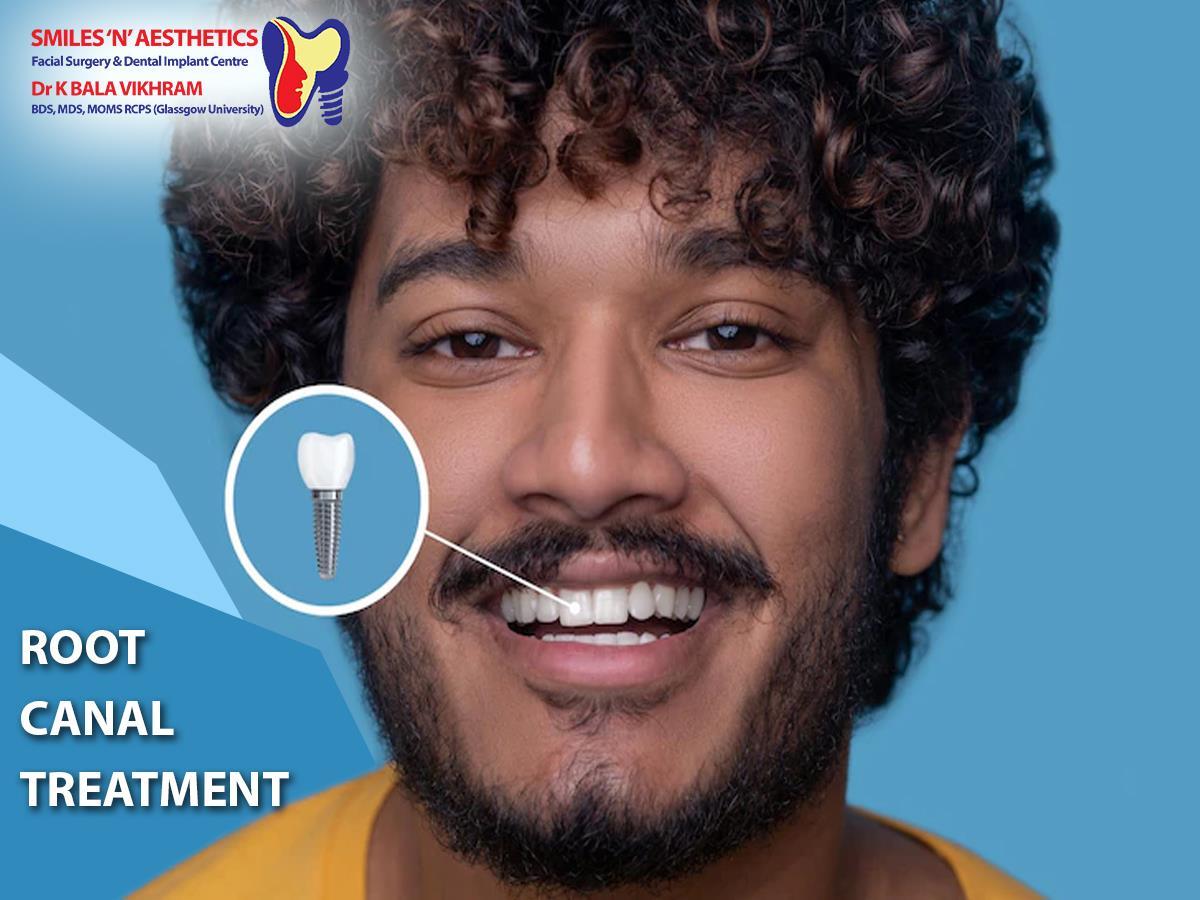 Is Root Canal Treatment Safe? by Smilesnaesthetics Issuu