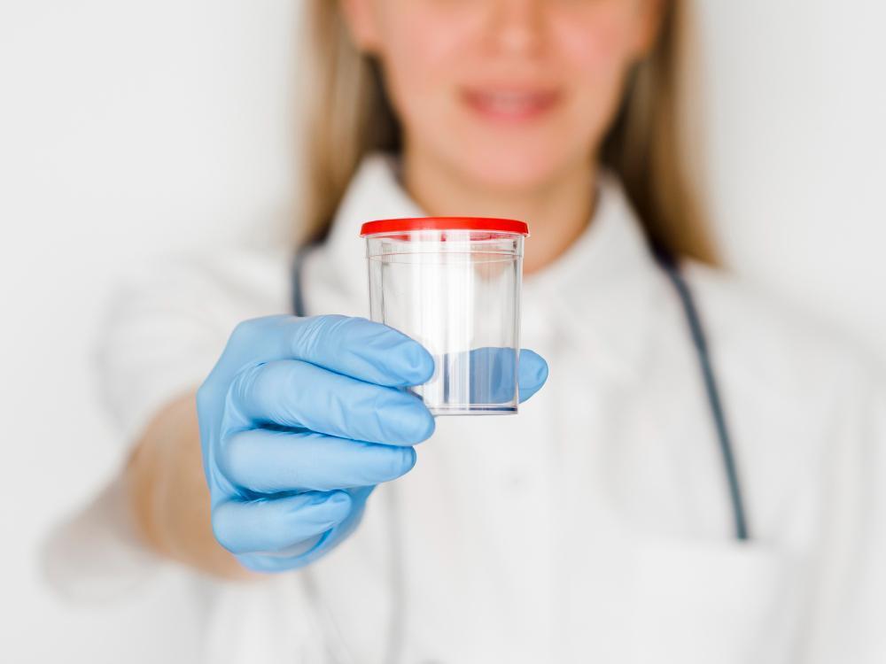 Drug Test Cups A Comprehensive Guide to Understanding Their Uses and