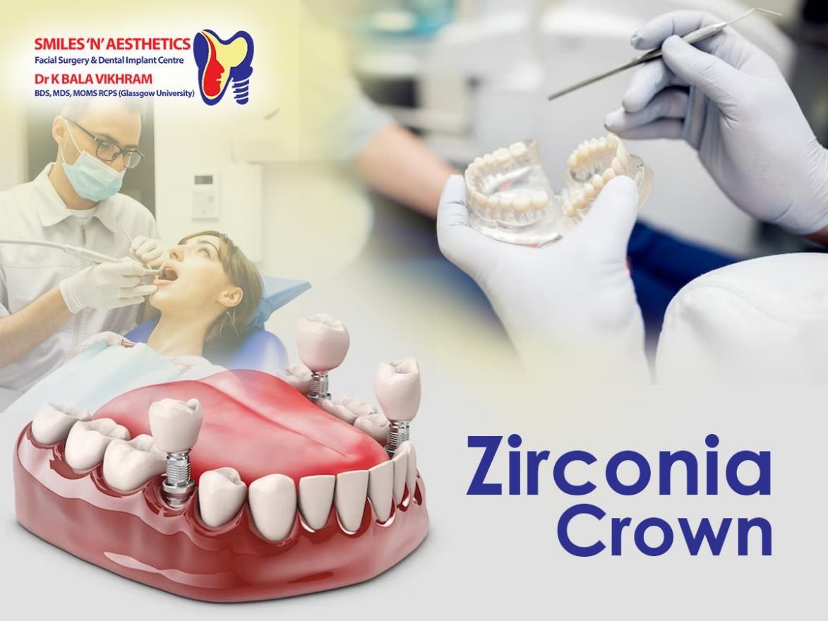 What to Expect When Going for a Zirconia Crown Procedure? by Smilesnaesthetics Issuu
