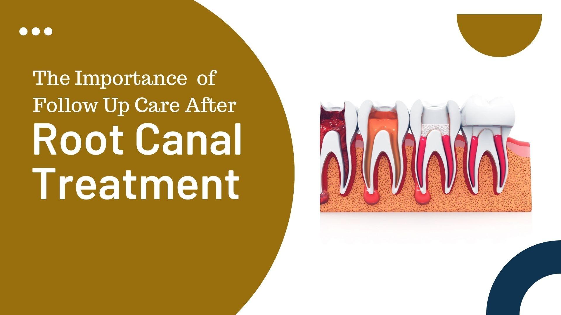 The Importance of FollowUp Care After Root Canal Treatment by Edna