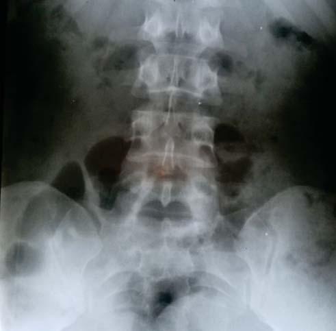 Cover for “LO IMPOSIBLE SE VOLVIÓ POSIBLE”