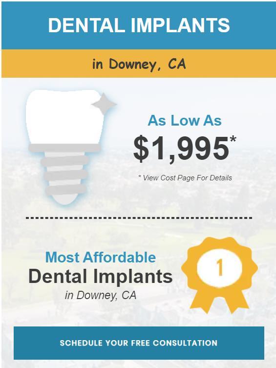 High Quality Dental Implants in Norwalk, CA by Adhp Services Issuu