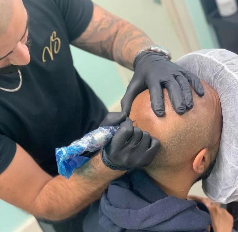 Scalp Treatment London by visionary scalps Issuu