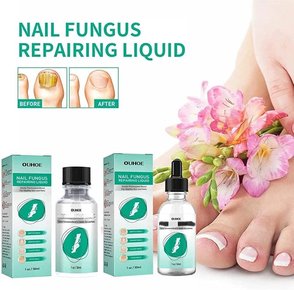 Dr Langdon Toenail Fungus — [SCAM ALERT] IS IT 100 PROFITABLE