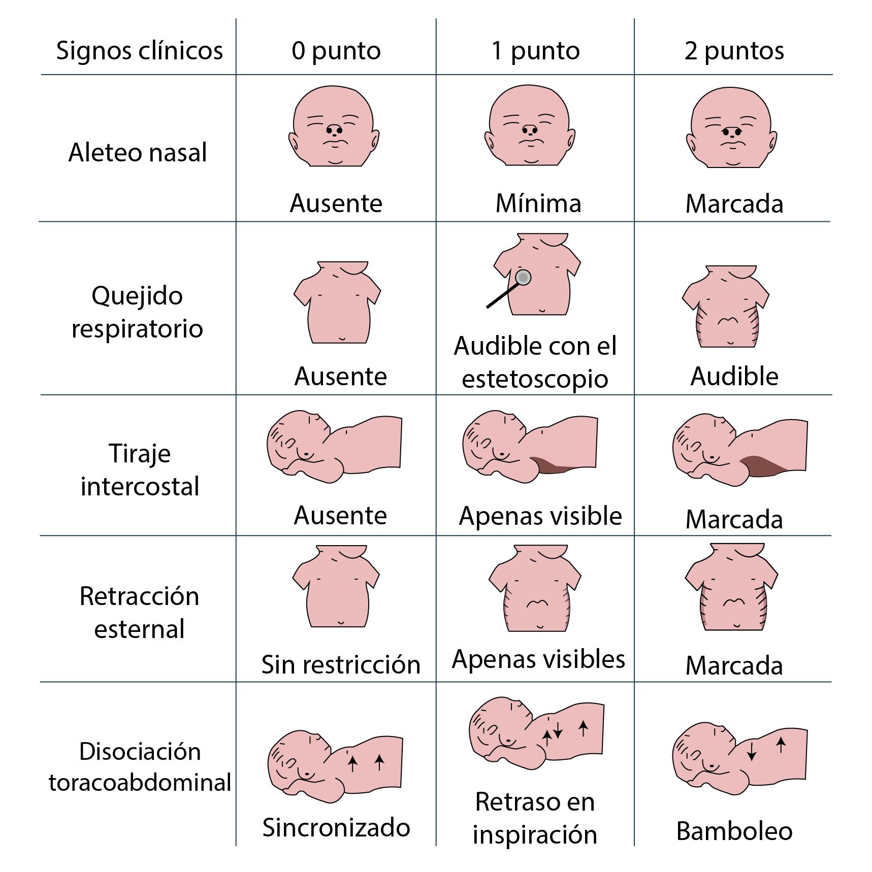 12. DIFICULTAD RESPIRATORIA EN EL RECIÉN NACIDO - Issuu