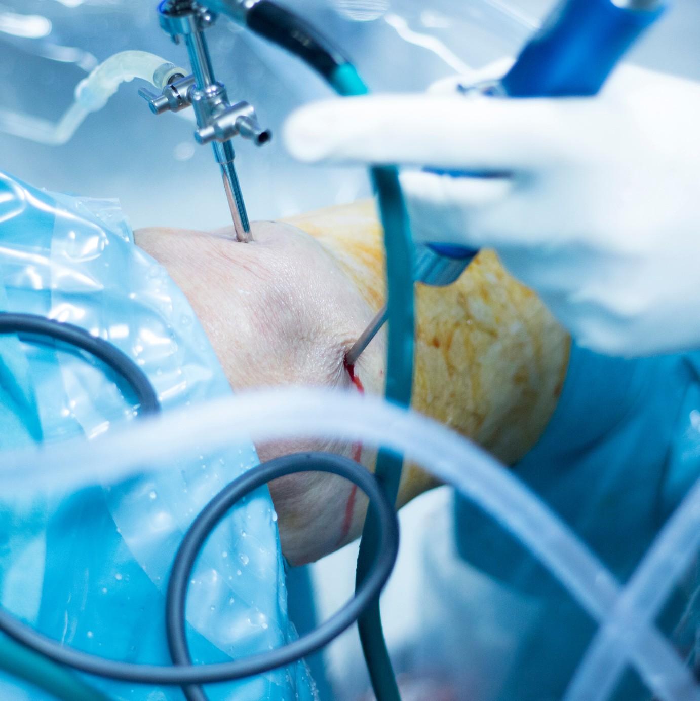 Benefits of Arthroscopic Knee Surgery by Arora Clinic Issuu