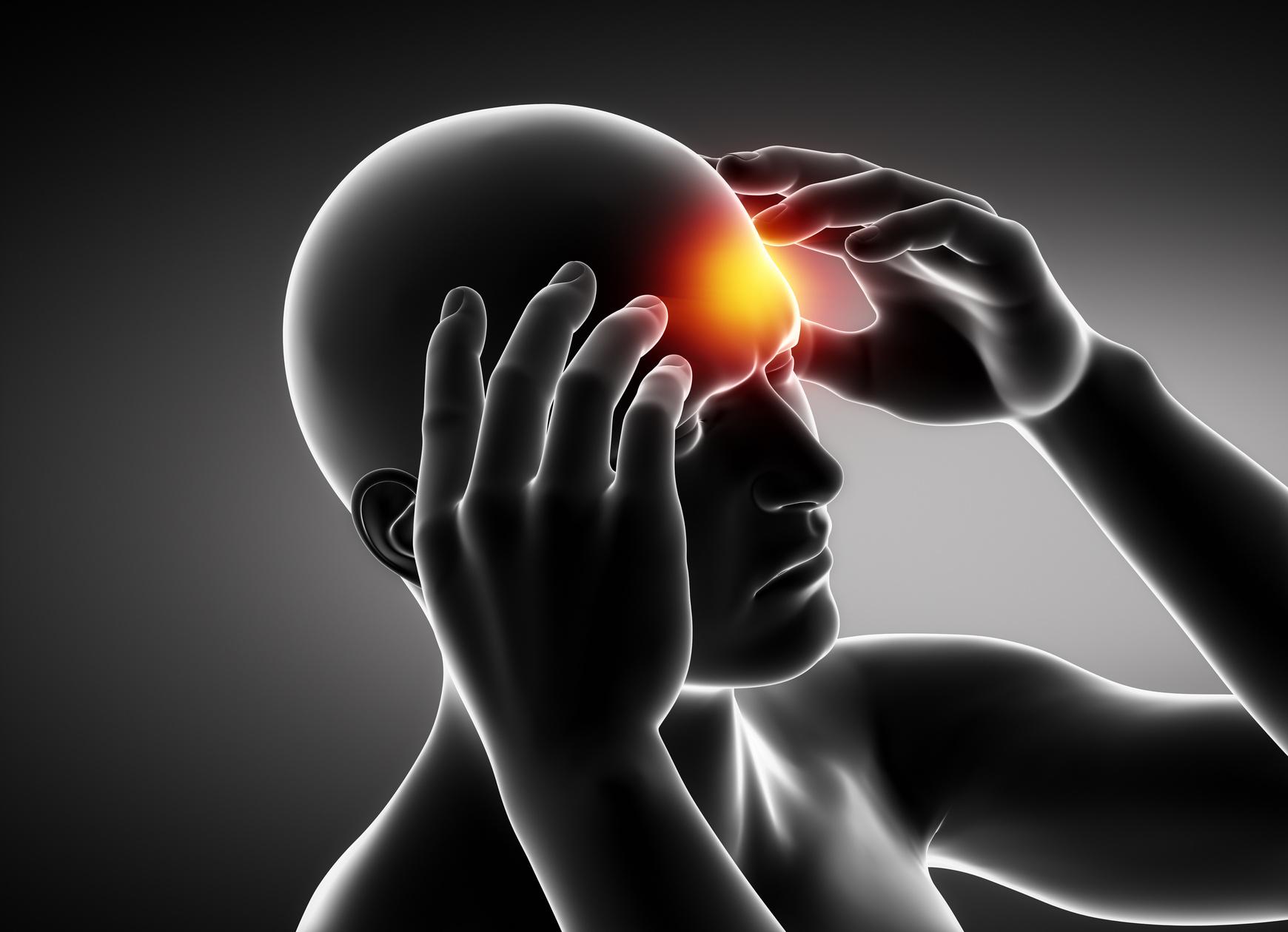 How to Manage HeatInduced Migraines Symptoms and Treatment by