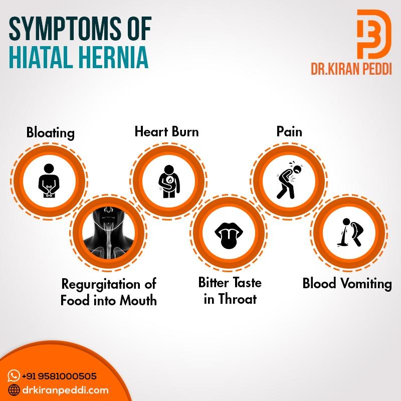 Hiatal Hernia Symptoms Hiatal Hernia Natural Remedies Axe, 41% OFF