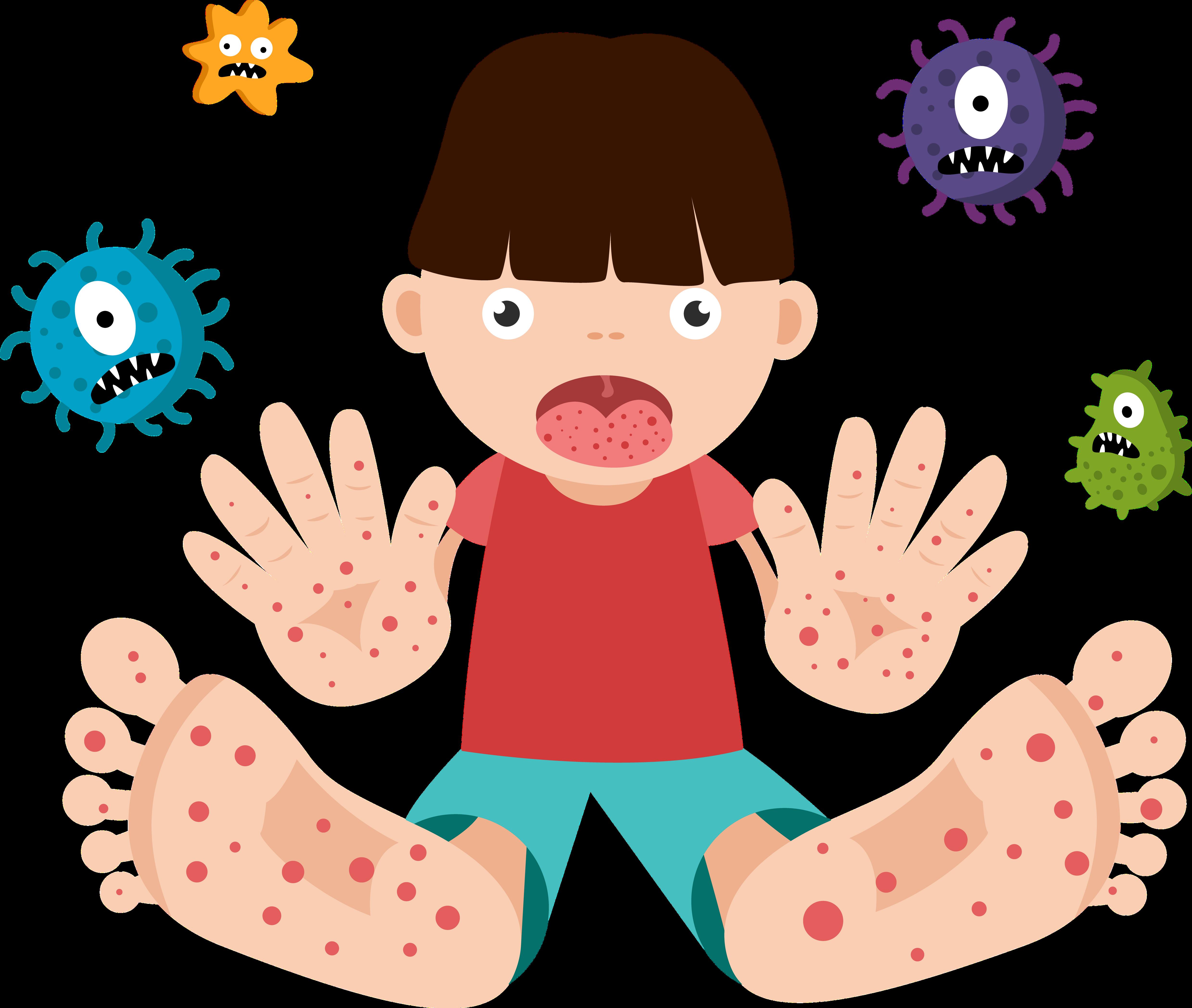 Guía para padres Enfermedad Boca manos pies by Wendy Anahy Issuu