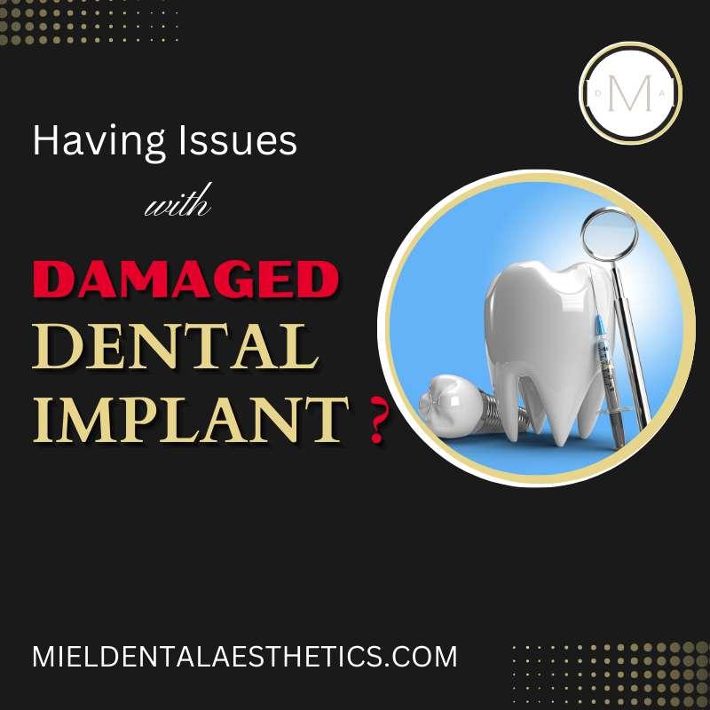 Dealing with Dental Implant Failure What You Need to Know by Miel Dental Aesthetics Peabody Issuu