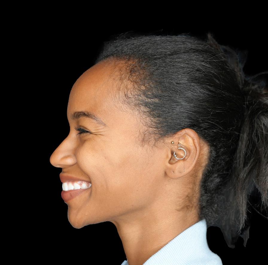 LaserAway Services Lookbook by LaserAway Issuu