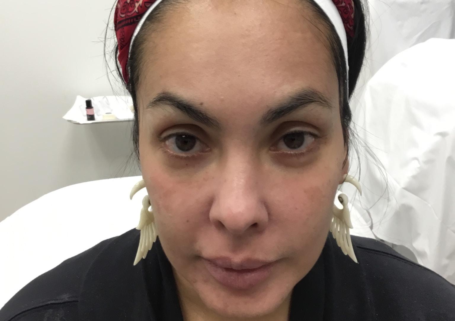 LaserAway Services Lookbook by LaserAway Issuu