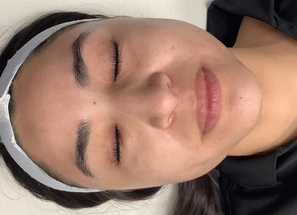 LaserAway Services Lookbook by LaserAway Issuu