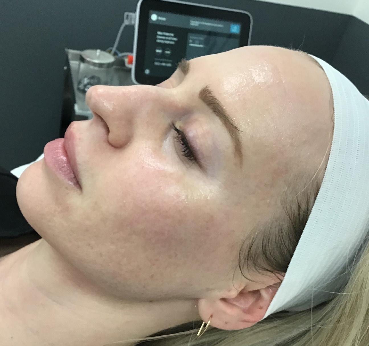 LaserAway Services Lookbook by LaserAway Issuu