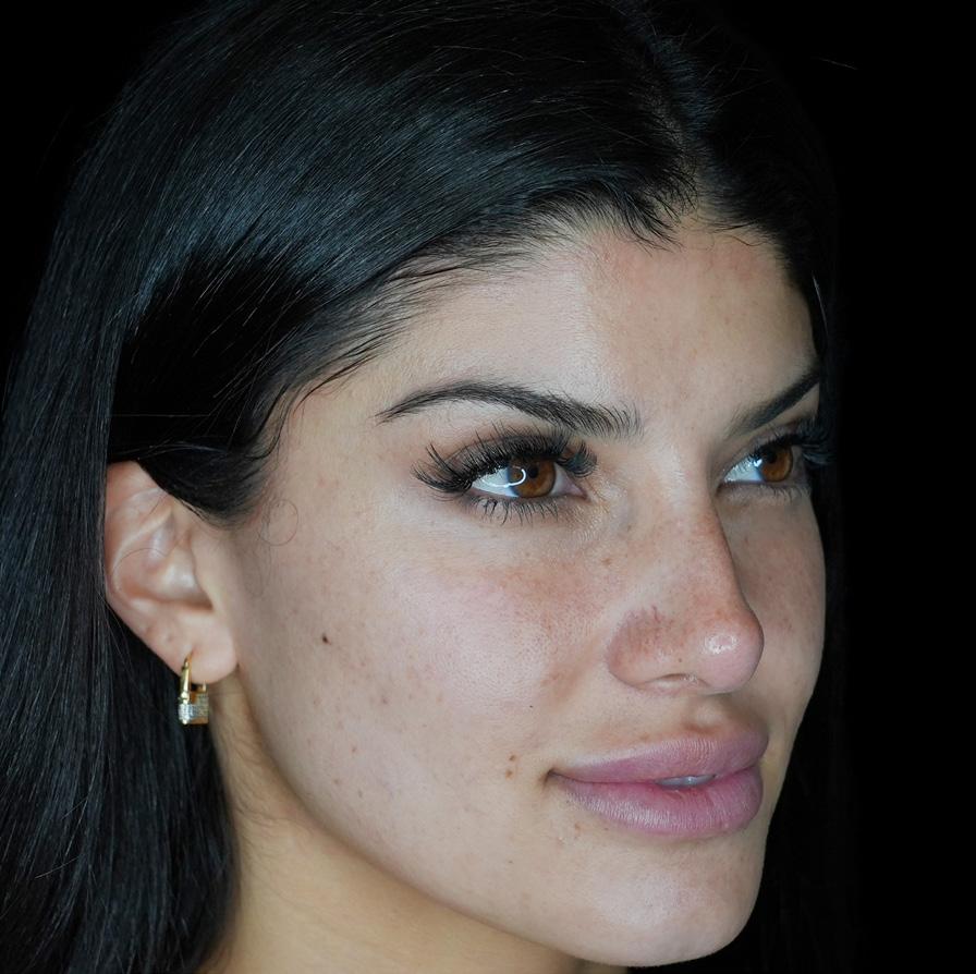 LaserAway Services Lookbook by LaserAway Issuu