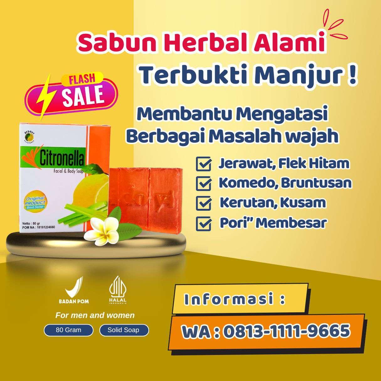 0813-1111-9665 TERPERCAYA, Jasa Izin Usaha Cianjur